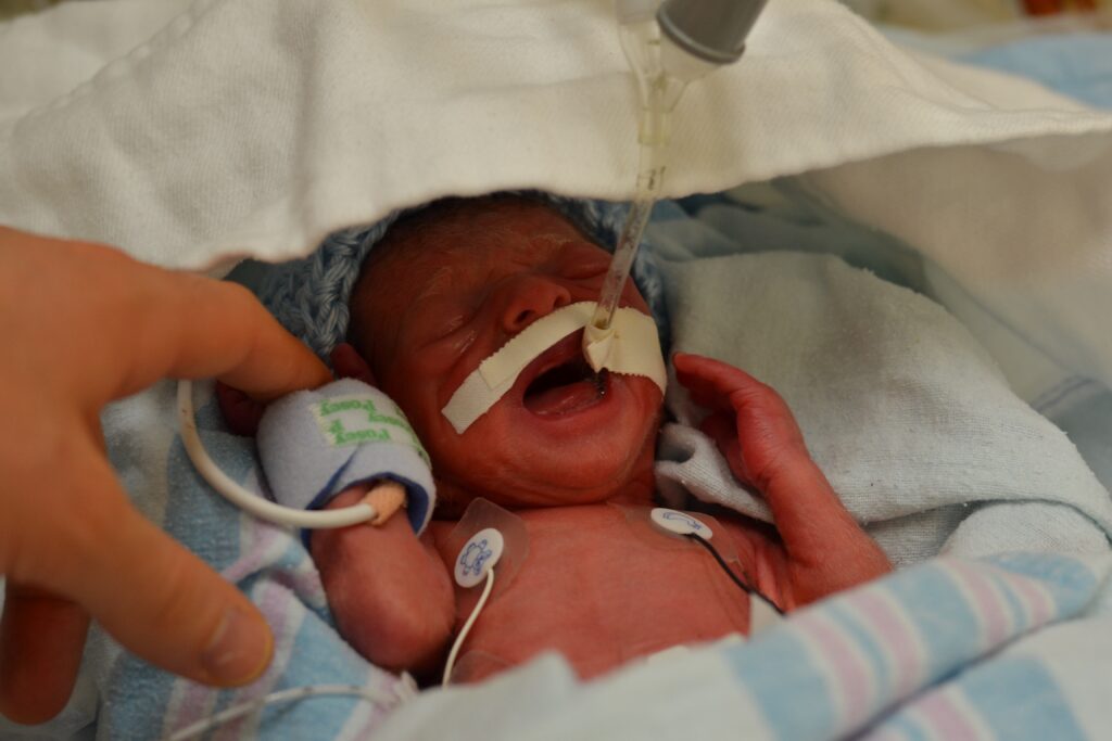 Micah in the NICU