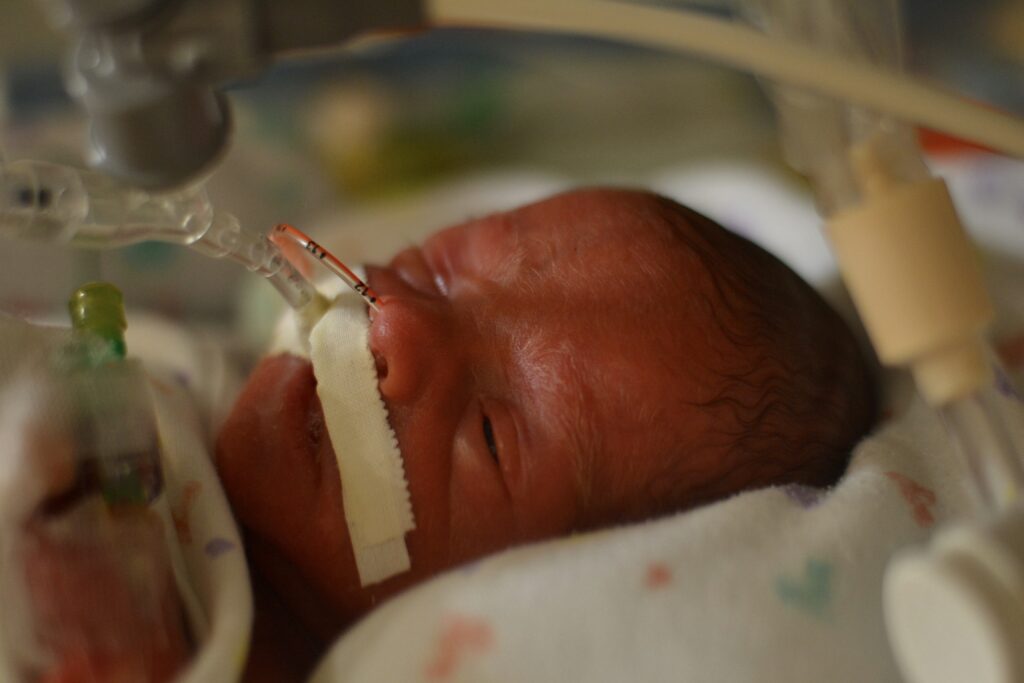 Zachary in the NICU