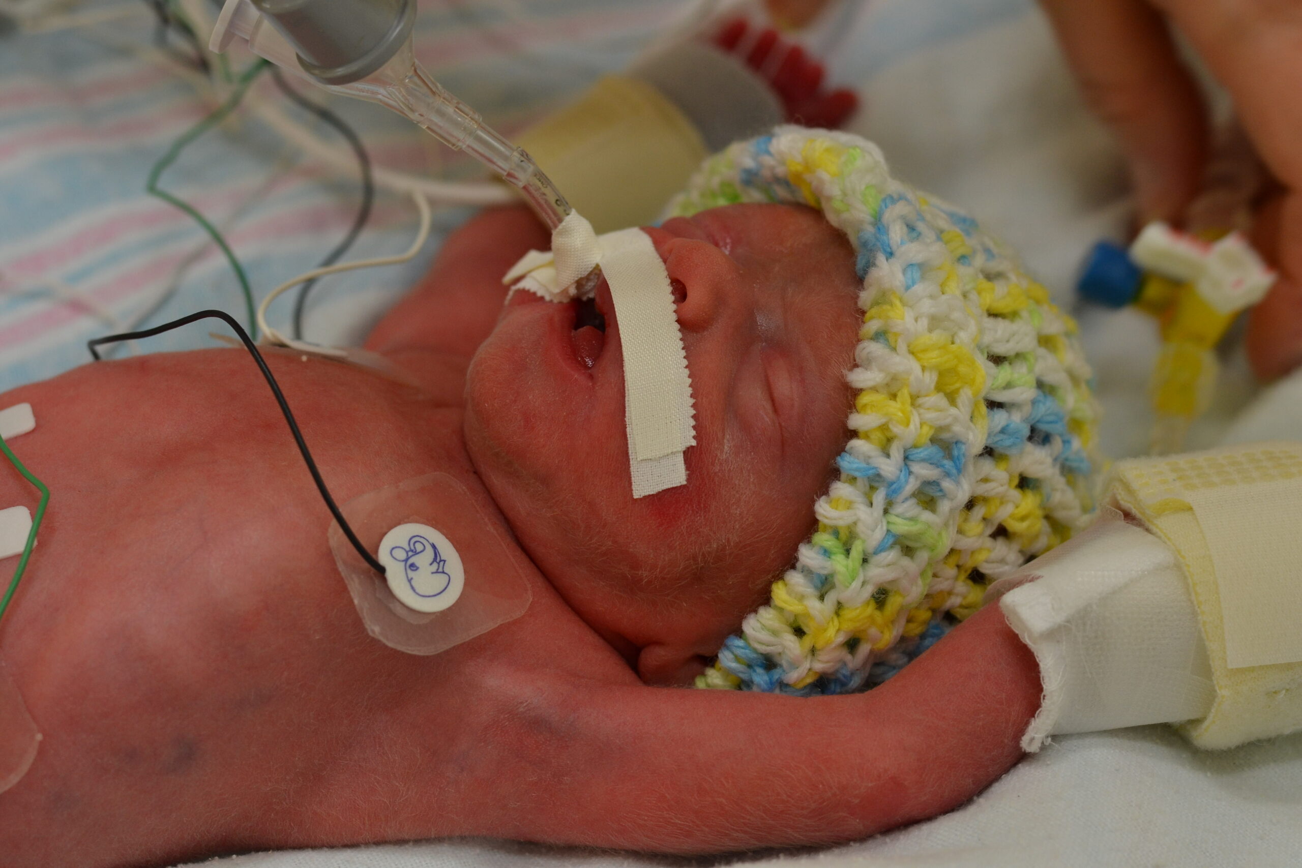 Zachary in the NICU