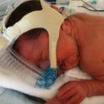 baby in the NICU