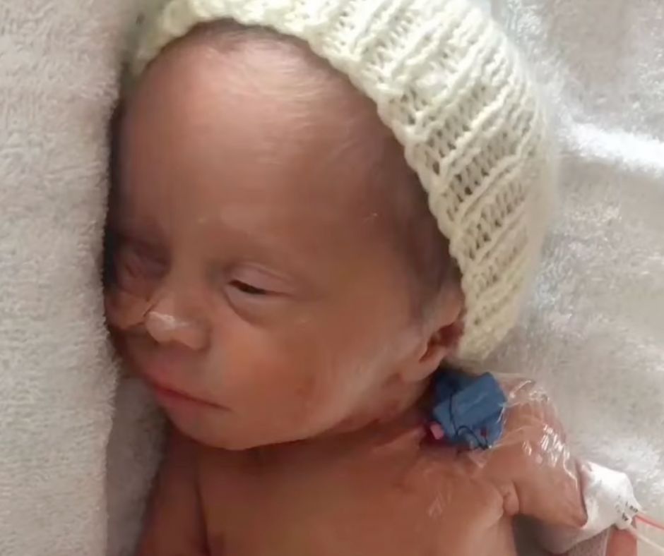 Matilda, Who passed away from NEC