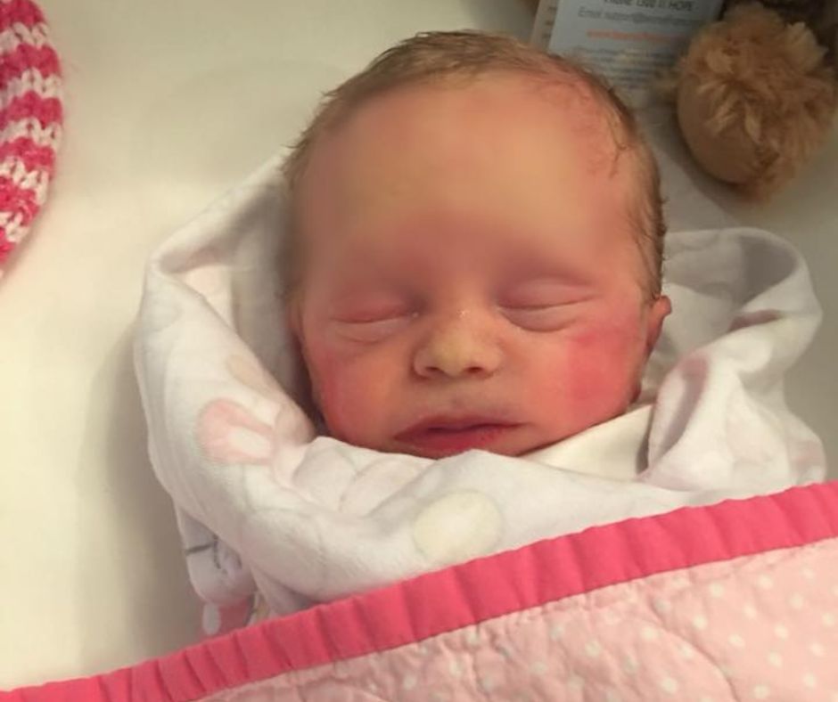 Matilda who passed away from NEC