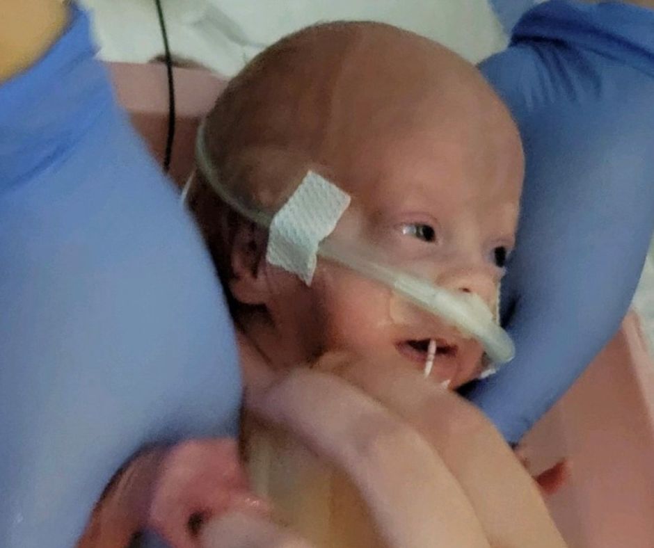 Nora who passed away from NEC