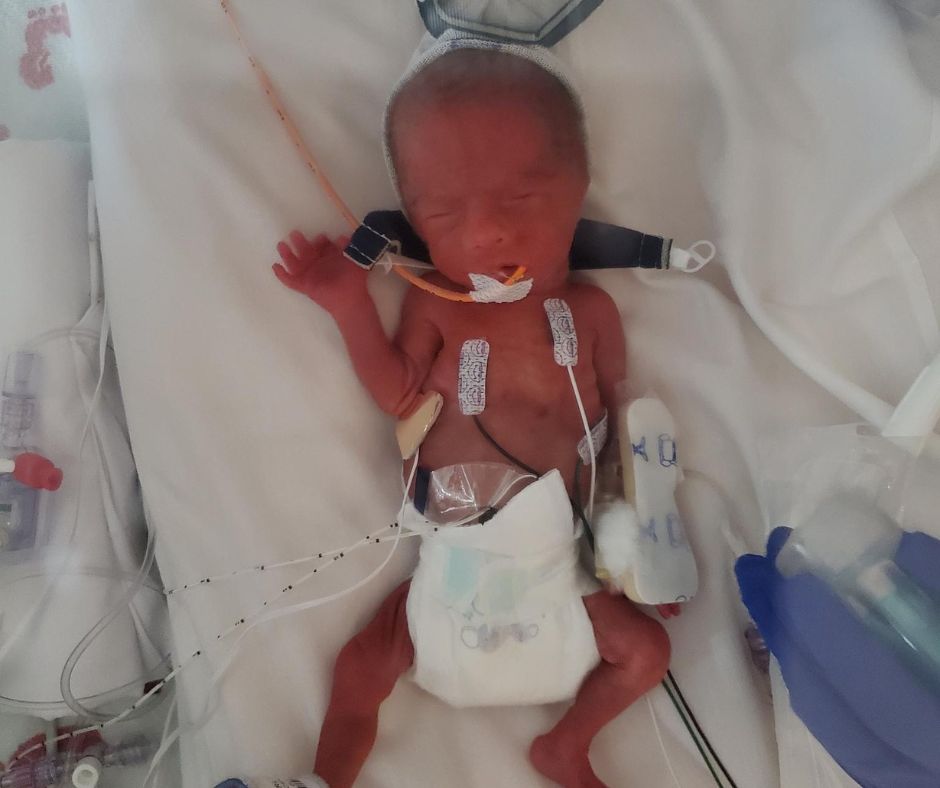 Remy, who passed away from NEC