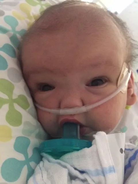 Close-up of a premature baby lying on a patterned pillow, using a pacifier, with nasal oxygen support in place.
