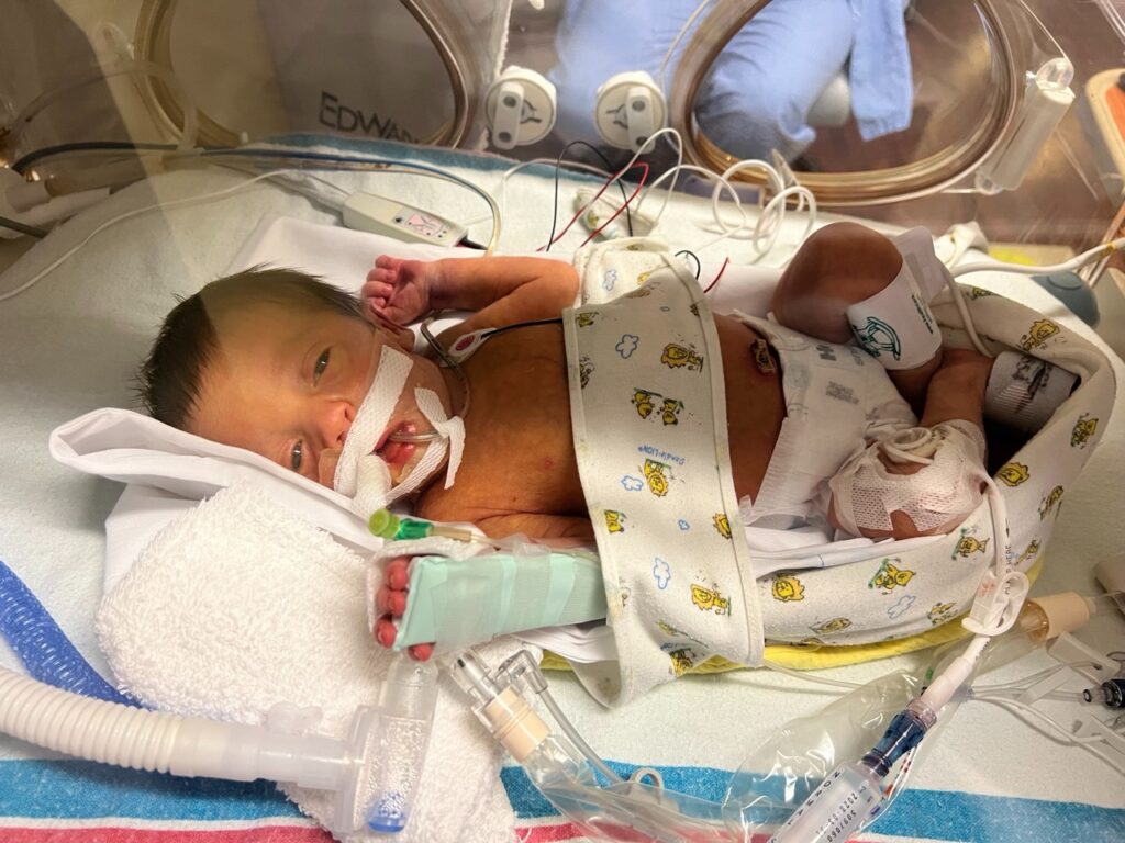 baby boy Walter in NICU